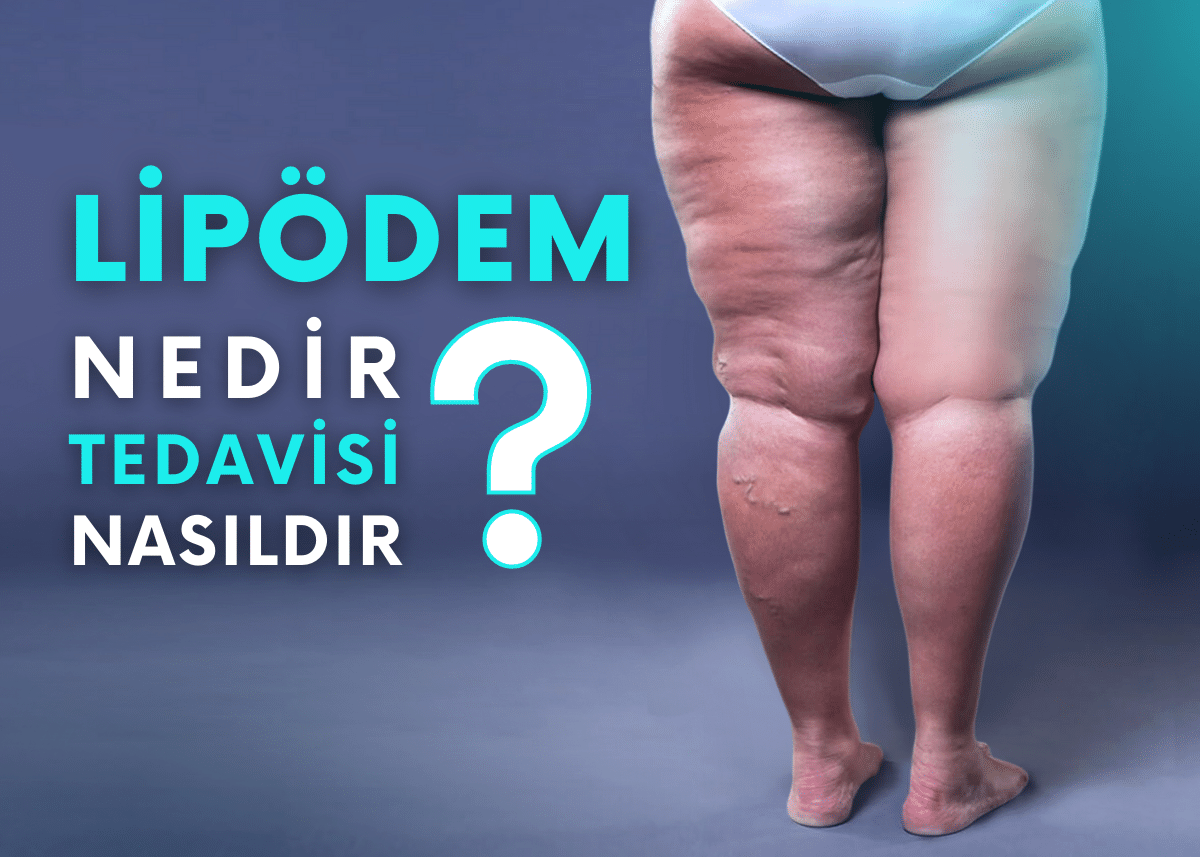 Sağlıklı Beslenme